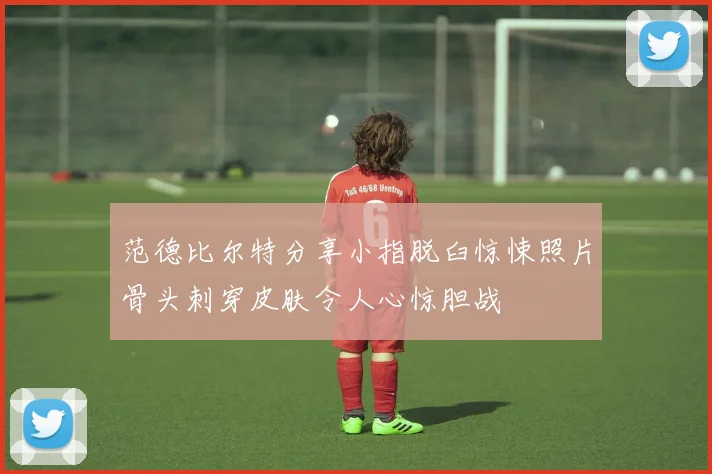 范德比尔特分享小指脱臼惊悚照片骨头刺穿皮肤令人心惊胆战